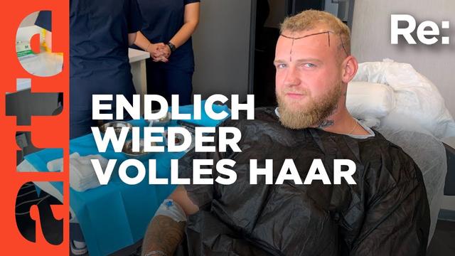Haartransplantation gegen Halbglatze | ARTE Re: