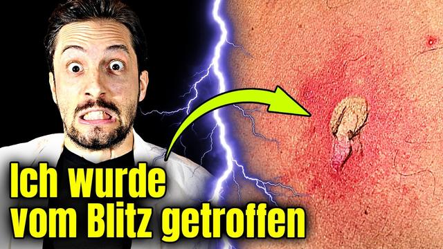 Ich wurde vom Blitz getroffen! Das hat es mit mir gemacht