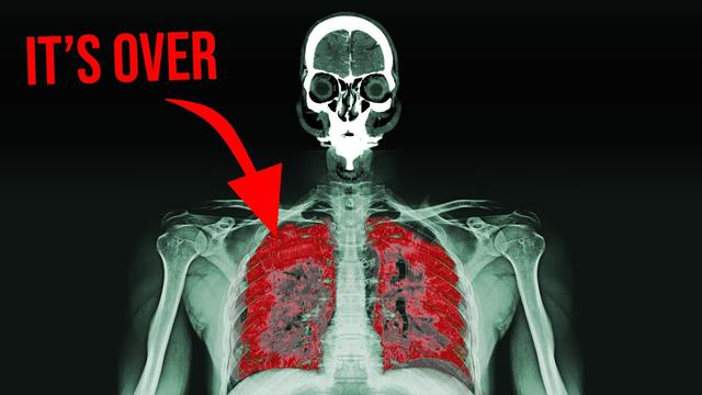 "It smelled funny while I was welding and now I can't breathe..."